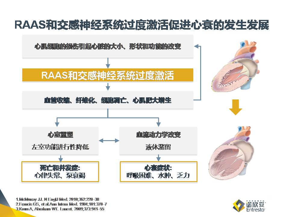 欧美指南演变见证心衰新型治疗药物的发展